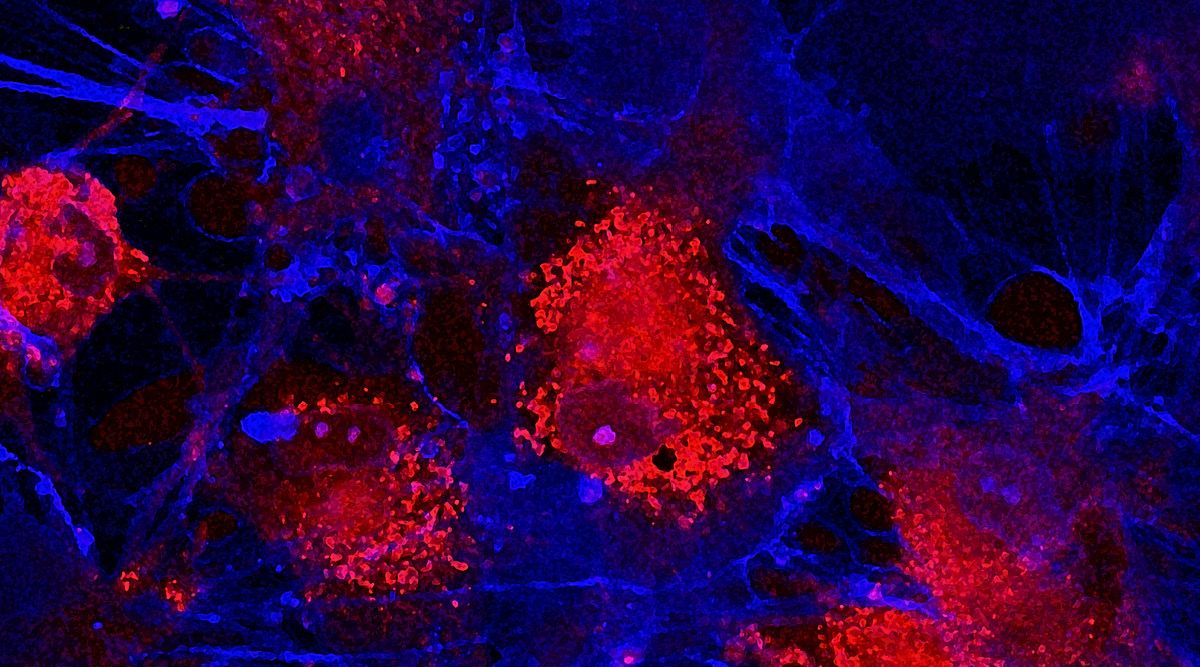 Microscopy image of red- and blue-dyed cells.