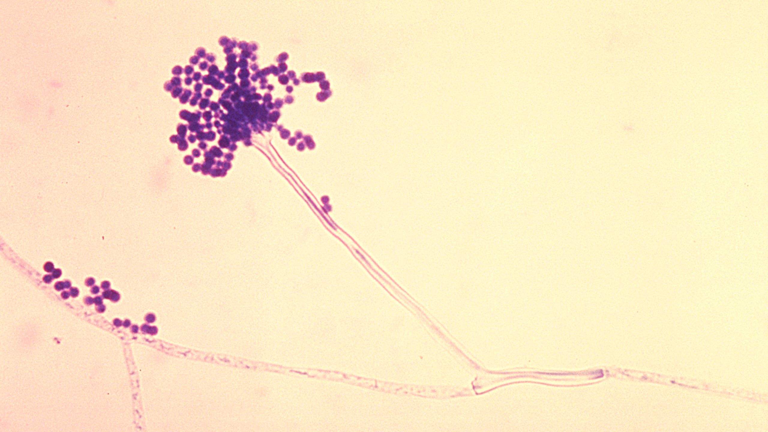 photomicrograph of Aspergillus fumigatus